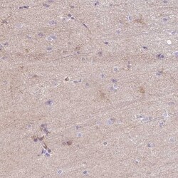 C2CD4C Antibody, Novus Biologicals:Antibodies:Primary Antibodies